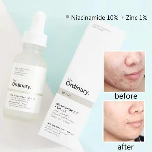 Ordinary Niacinamide Serum (original) imported 50% discount